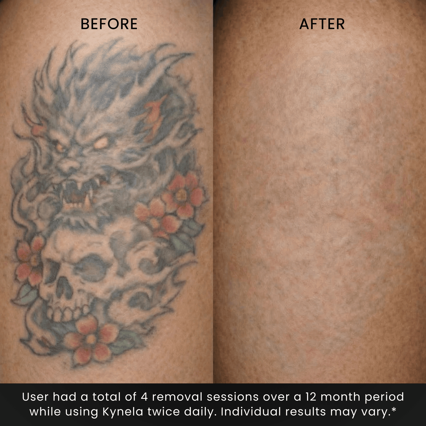 Natural Restoration Active Botanical Serum