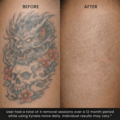 Natural Restoration Active Botanical Serum