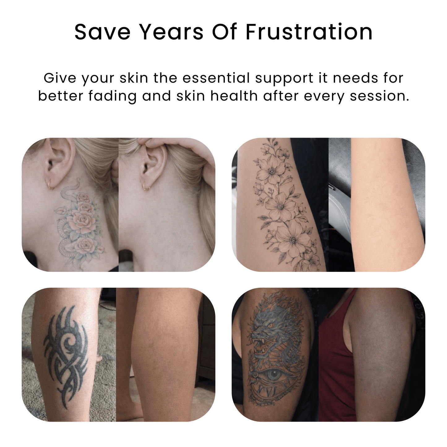 Active Botanical Skin Restoration Serum